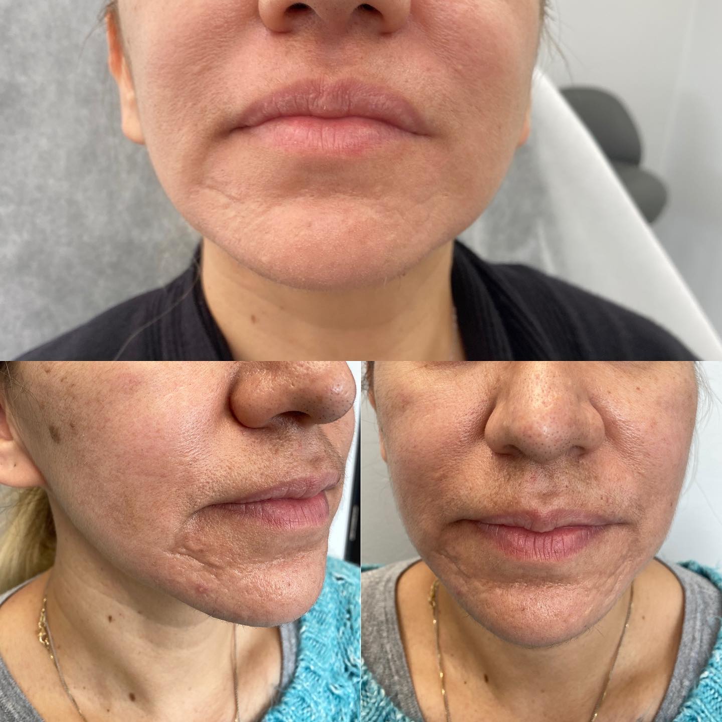 What we started with (bottom photos) what we have now! Our beautiful client started her skincare journey a few months ago wit