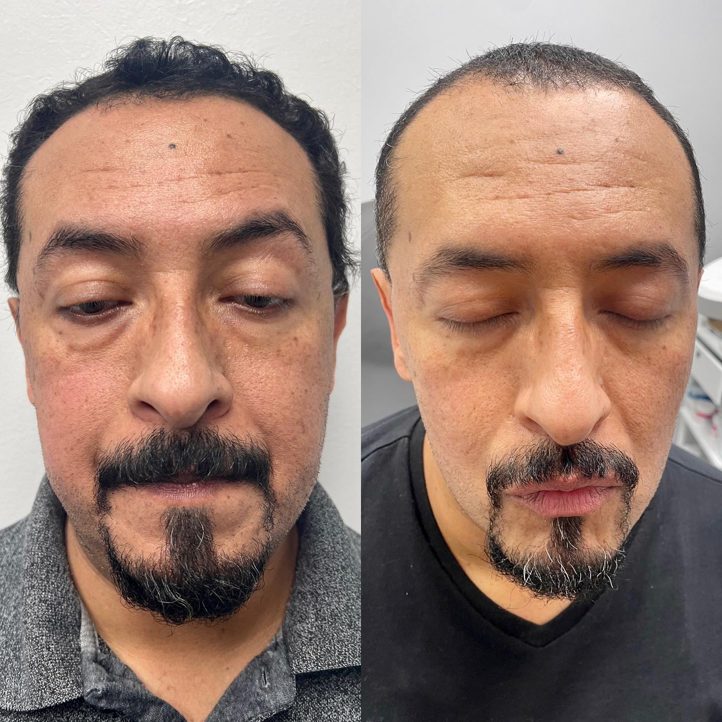 We get asked if we get a lot of male clients, the answer is yes. About 20-30% of our clients are men! Skin treatments are get