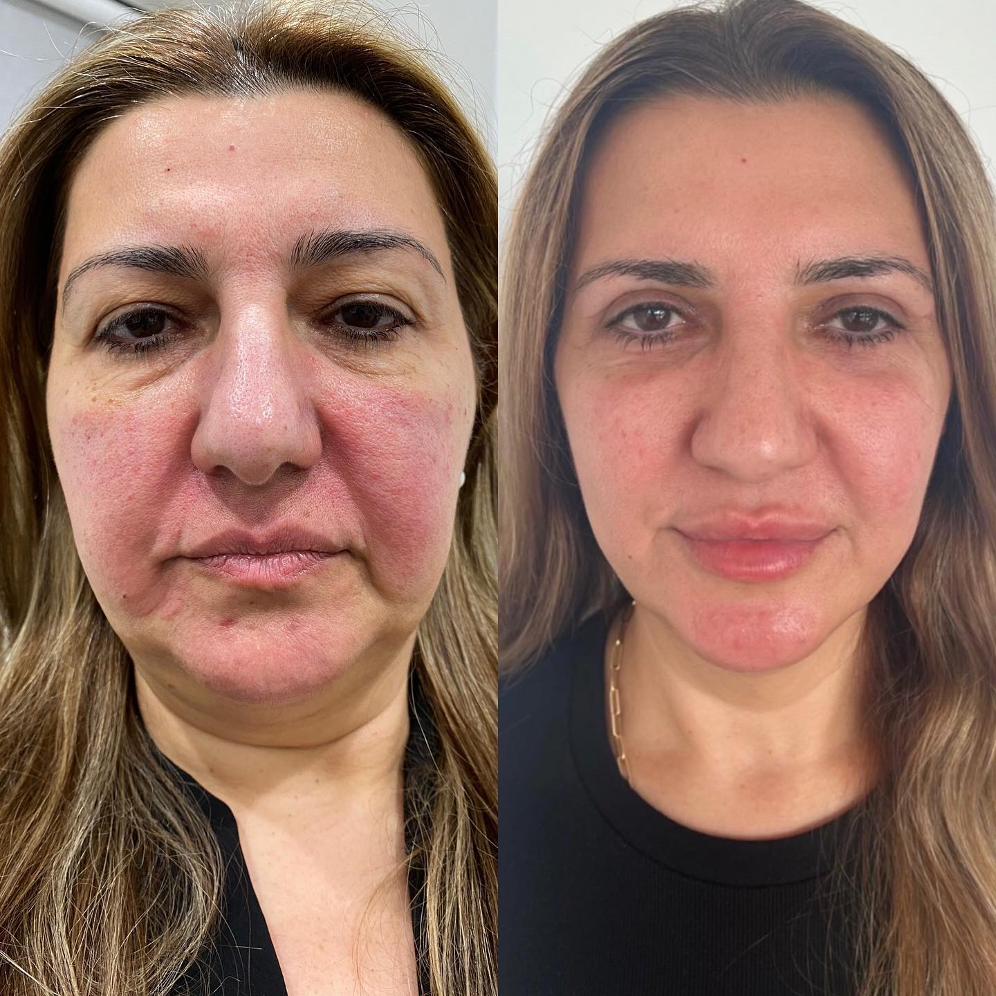 Our Morpheus Queen! The first photo was taken 2 years ago, the second one was taken 3 days ago. Clients transformation is ama