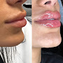 Russian lip