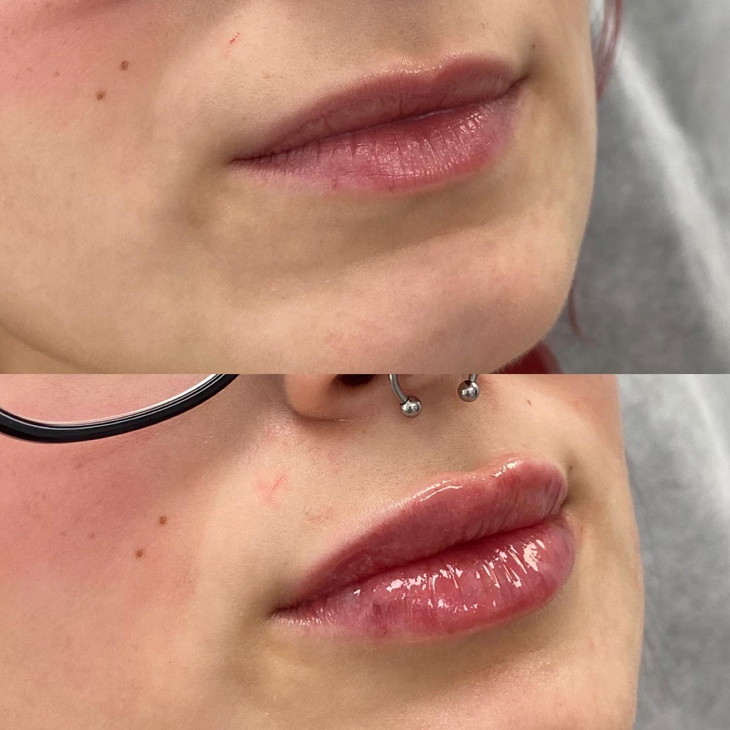 💋We love lip plumpness and hydration! Half syringe $450 Full syringe $499 (December special) . . #skinsationla #losangeles…