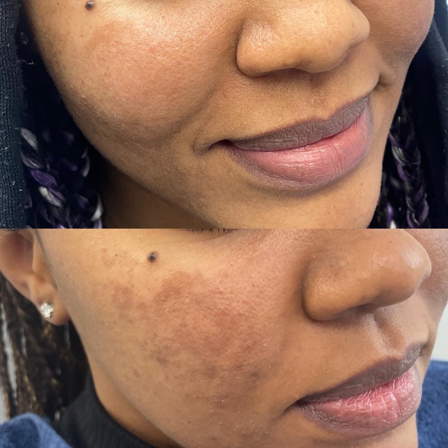 Let’s talk about the importance of skincare. When we want to get in shape, we’re told that half of it is going to the gym, an